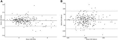 Pediatric percentiles for transient elastography measurements - effects of age, sex, weight status and pubertal stage